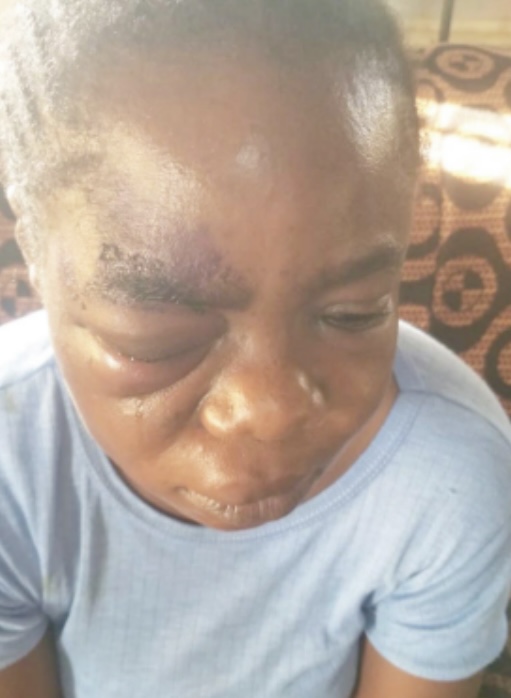 Man Arrested For Brutally Assaulting His Wife in Osun 1 Man Arrested For Brutally Assaulting His Wife in Osun